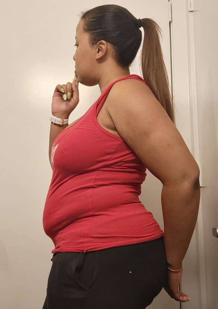 Photo of 7 months postpartum