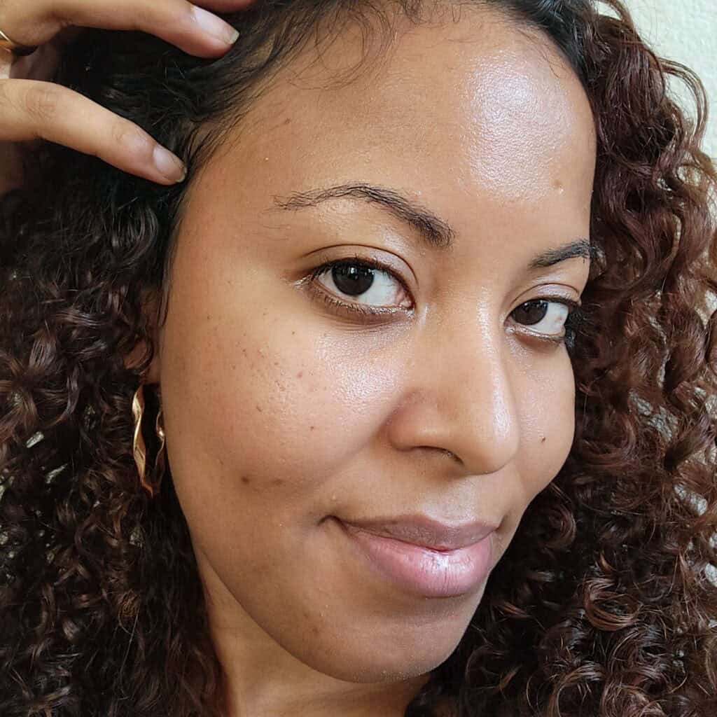 Closer look at smooth skin and fading acne scars after HydraFacial care