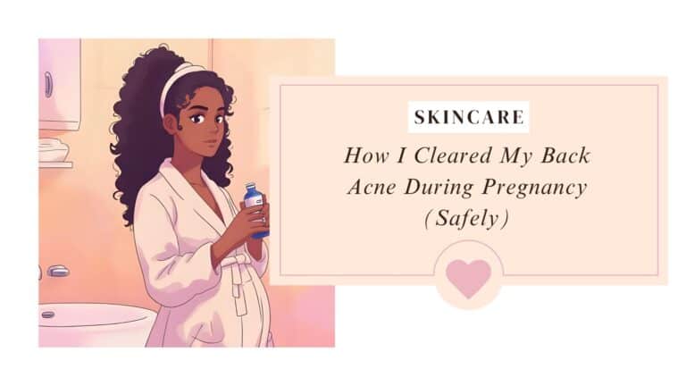 Anime illustration of a pregnant woman in a bathrobe holding skincare spray bottle, representing pregnancy-safe skincare routine for back acne.