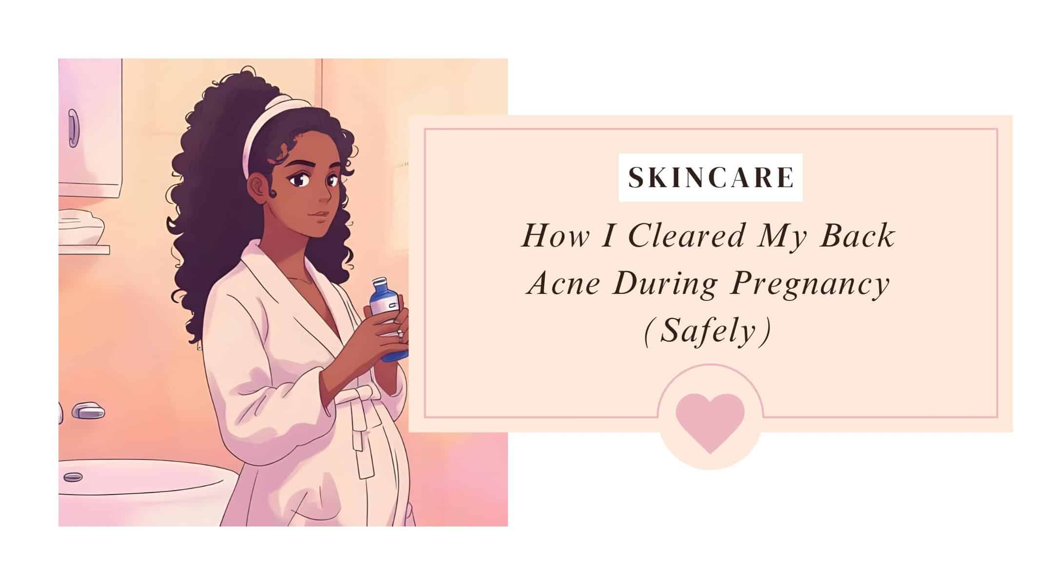 Anime illustration of a pregnant woman in a bathrobe holding skincare spray bottle, representing pregnancy-safe skincare routine for back acne.