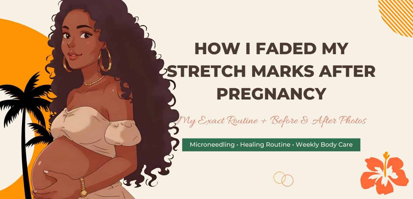 Illustrated tropical-themed blog cover featuring a pregnant woman with curly hair and hoop earrings on the left, tropical palm trees and orange accents in the background, and the title “How I Faded My Stretch Marks After Pregnancy” displayed on a cream backdrop with hibiscus and island-inspired details.